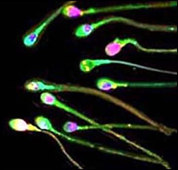 Донора спермы заставляют платить алименты - 20071204155849320_1