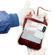 Сенсация! Организм девочки изменил резус-фактор крови - 20080125164838324_1